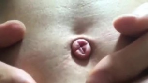 Belly Button Needle